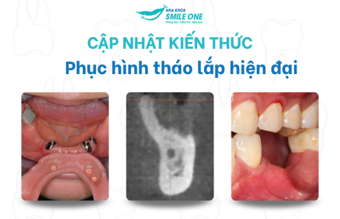 Nha khoa Smile tham dự Workshop “Phục hình tháo lắp hiện đại”